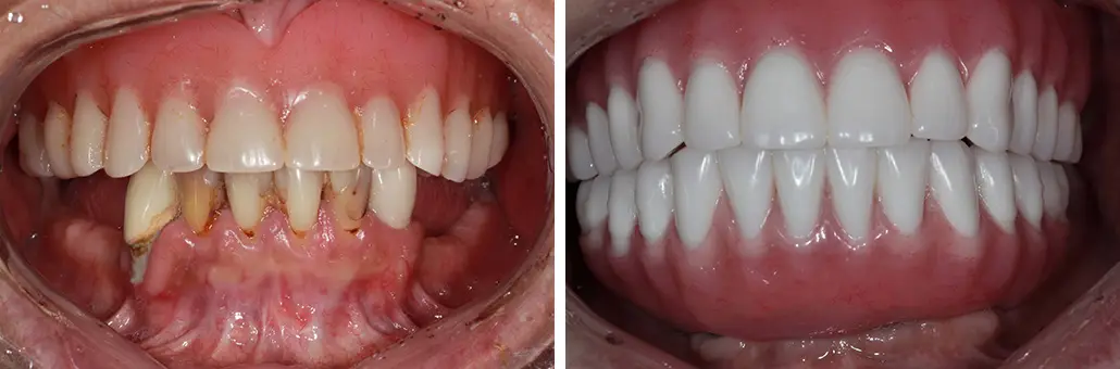 Dentures Driffield